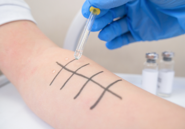 Allergy/Immunology Practice